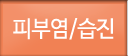 피부염/습진